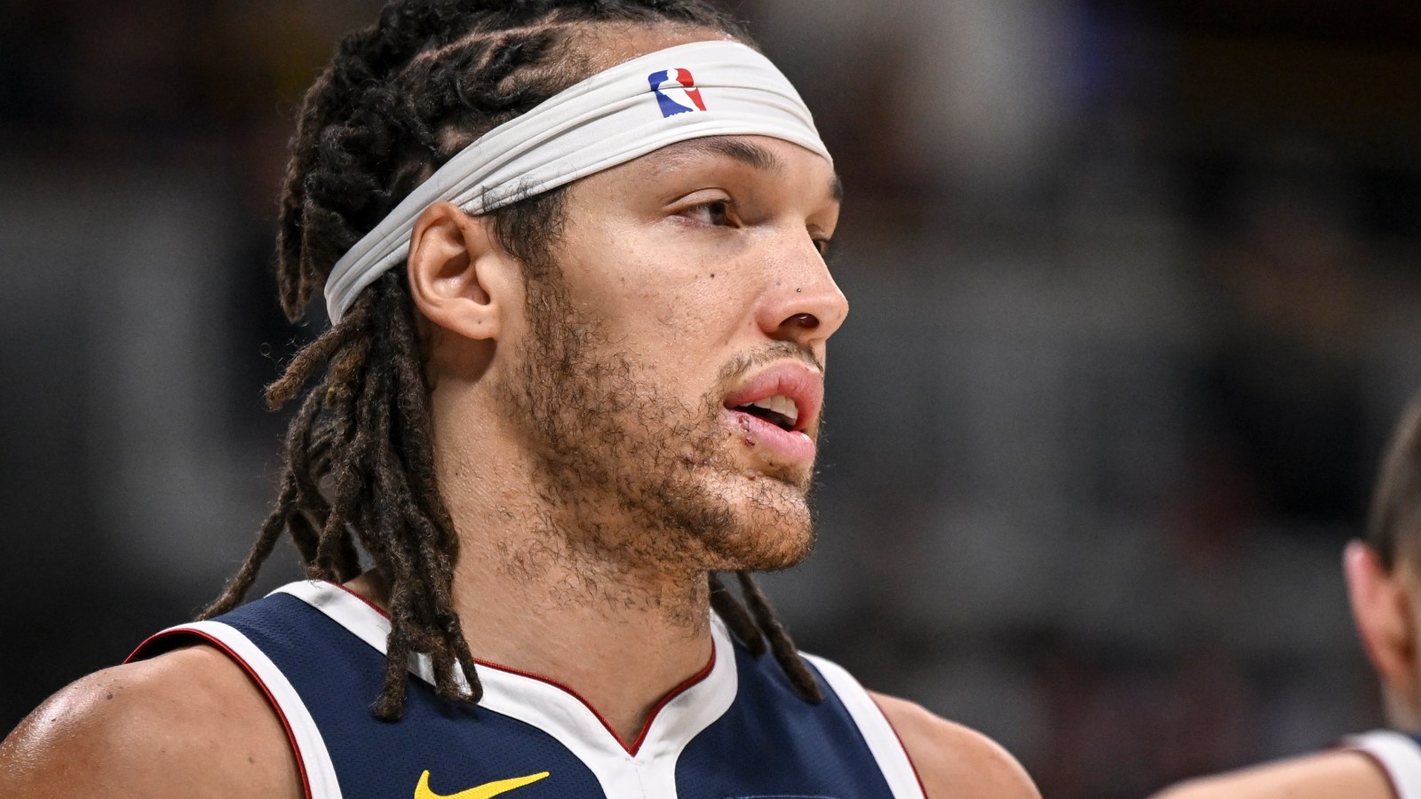 aaron gordon dog attack, what we know about the situation that happened recently