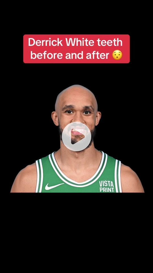 Derrick White Teeth: What Happened? A Look at His Smile Transformation Through the Years