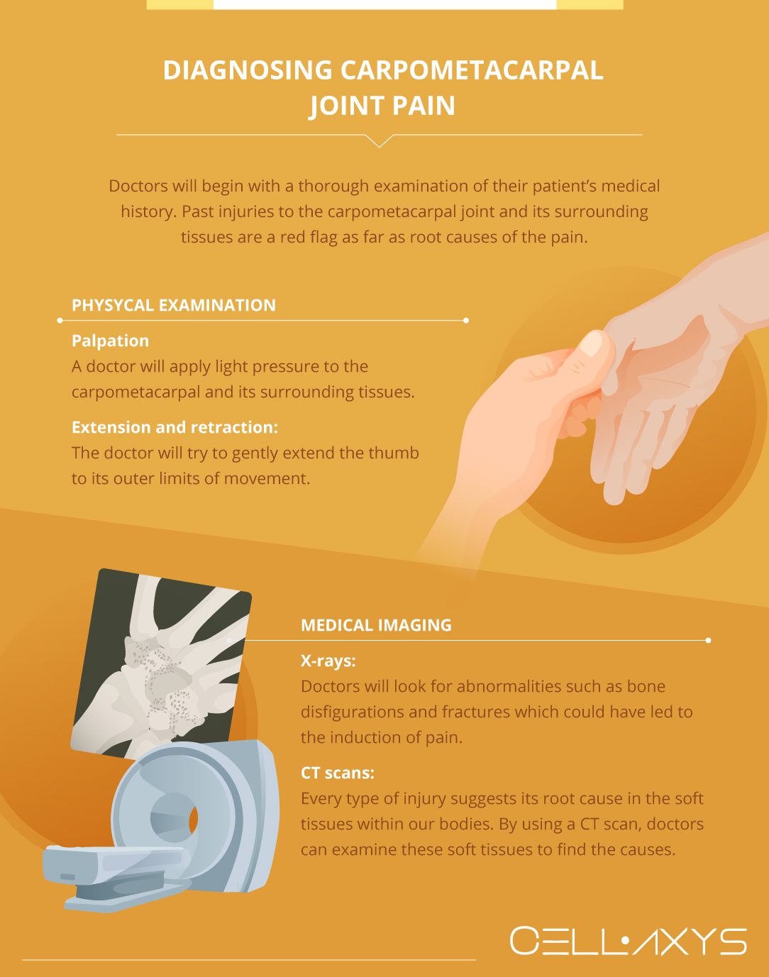 Dealing with CMC Injury: Easy Tips for Pain Relief at Home.