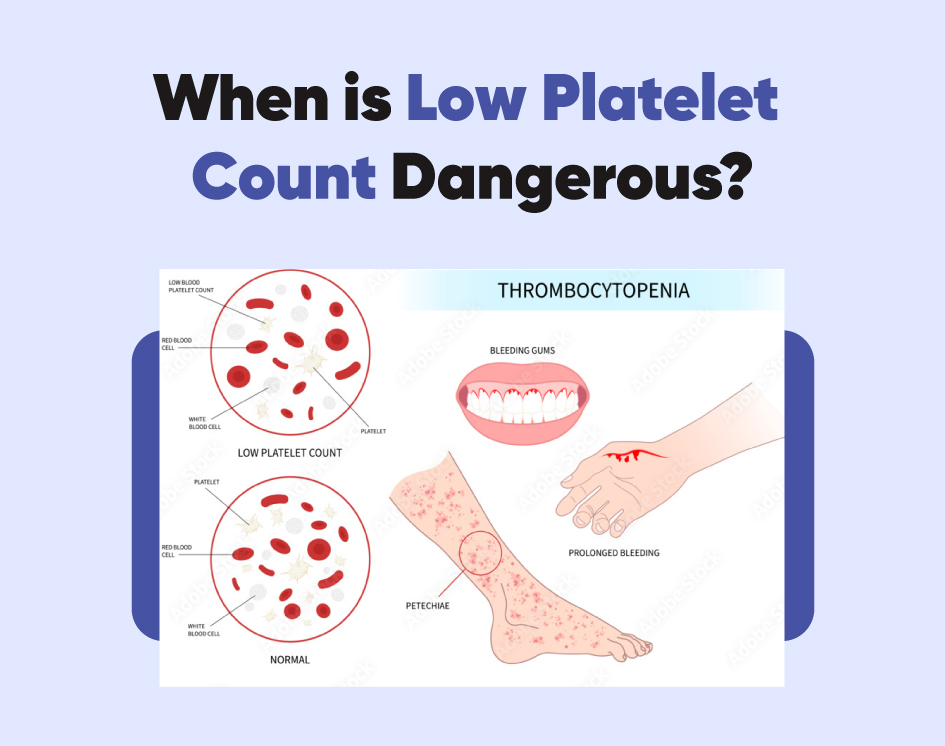 What is a platel? Heres everything you should know about platel!