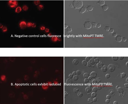 What is TMRE and how does it work for you?