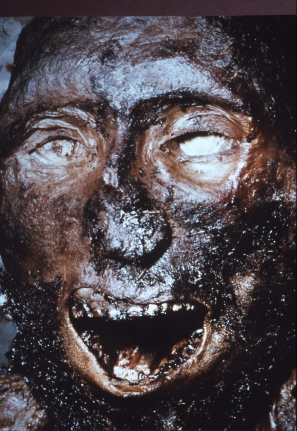 St Bees Man Face Reconstruction: Secrets From the Iron Age Revealed
