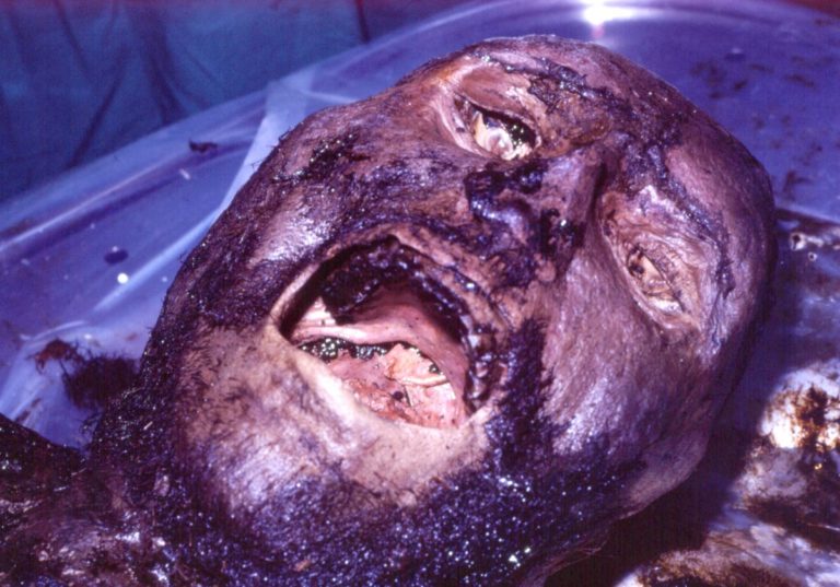 St Bees Man Face Reconstruction: Secrets From the Iron Age Revealed
