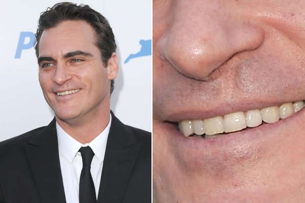 How does Joaquin Phoenix Harelip inspire others? Uplifting lessons shared!